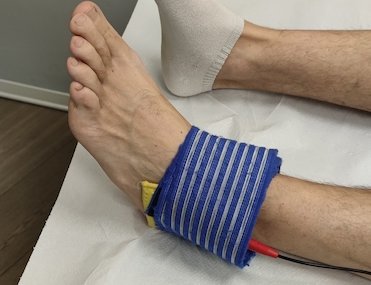 Tens per distorsione alla caviglia eseguita presso Fisiobaso Centro di fisioterapia a Ciampino