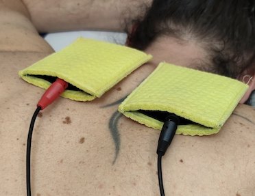Ionoforesi alla spalla eseguita presso Fisiobaso Centro di fisioterapia a Ciampino