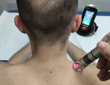 Laser alta potenza con Klaser per cervicale eseguita presso Fisiobaso Centro di fisioterapia a Ciampino