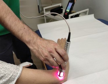 Laserterapia con Klaser alta potenza per epicondelite eseguita presso Fisiobaso centro di fisioterapia a Ciampino