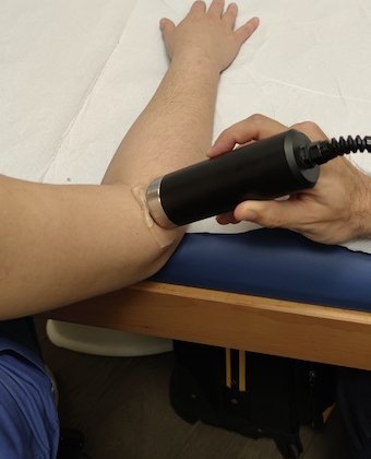 Terapia con ultrasuoni al gomito per epicondilite presso il Centro di fisioterapia Fisiobaso a Ciampino